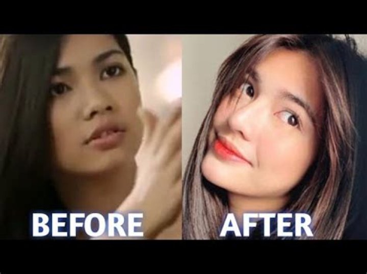 Before Surgery Jane de Leon Face & Darna Costume Unreal Transformation Will Surprise You