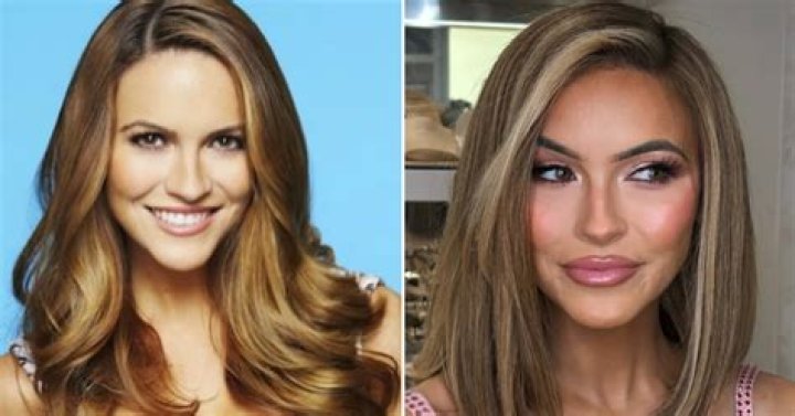 Reddit: Selling Sunset Cast Before and After Plastic Surgery!