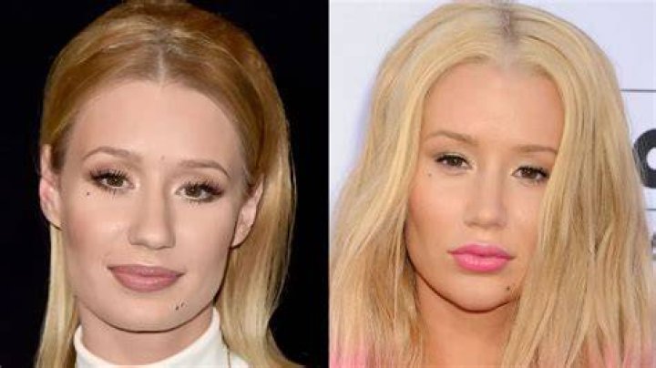 What Happened To Iggy Azalea And Why Is She Taking A Break? Status Update On The Singer